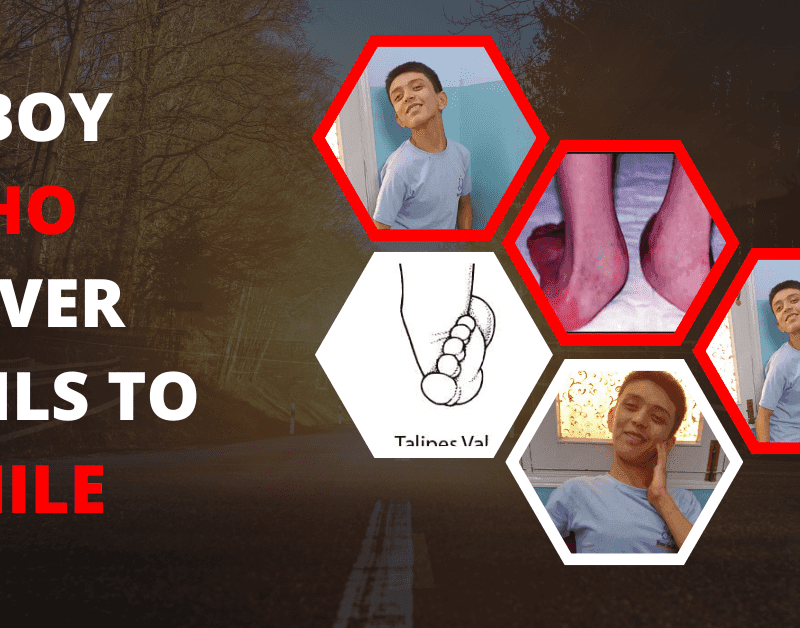 A BOY WHO NEVER FAILS TO SMILE